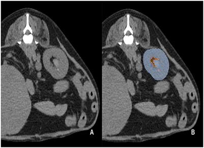 A deep learning model for automated kidney calculi detection on non-contrast computed tomography scans in dogs